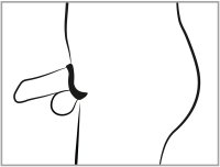 Vista previa: Penis Käfig mit Dilator