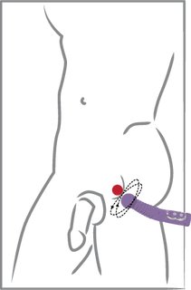 Prostate Twister para ordeñar la próstata