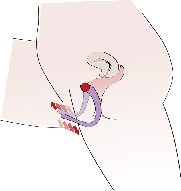aplicación de labiales-distribución-lateral-adicción